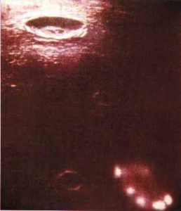 Apollo1 ufo1